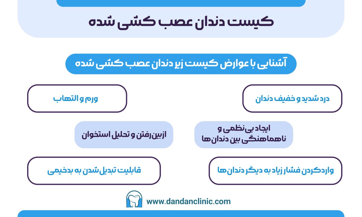 کیست دندان عصب کشی شده
